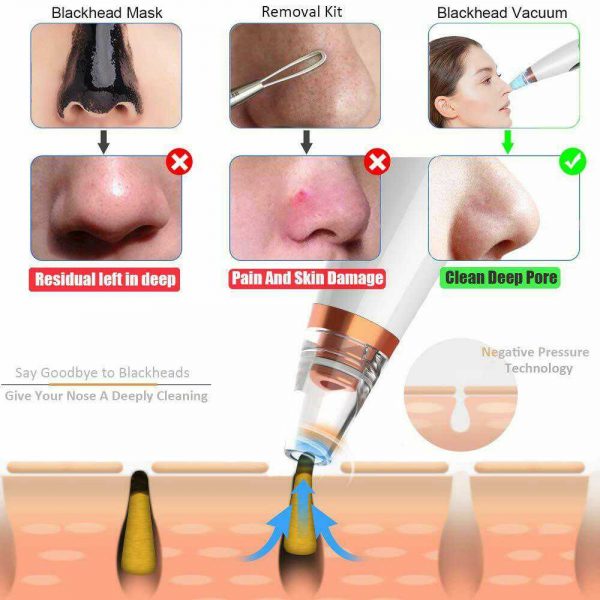 Electric Facial Skin Care Pore Blackhead Remover Cleaner Vacuum Acne Cleanser (11)