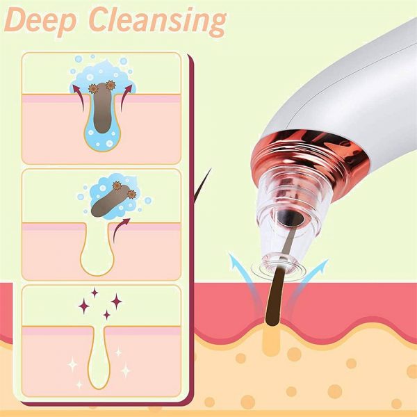 Facial Pore Blackhead Acne Vacuum Cleaner Remover Electric Skin Cleaner Care Uk (18)