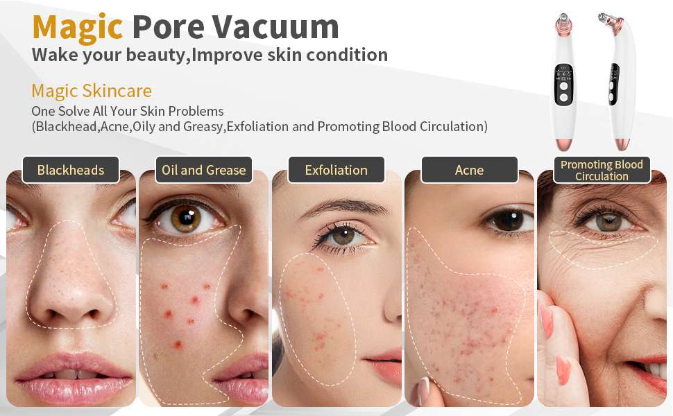 Facial Pore Blackhead Acne Vacuum Cleaner Remover Electric Skin Cleaner Care Uk (20)
