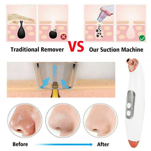 Facial Pore Blackhead Acne Vacuum Cleaner Remover Electric Skin Cleaner Care Uk (6)